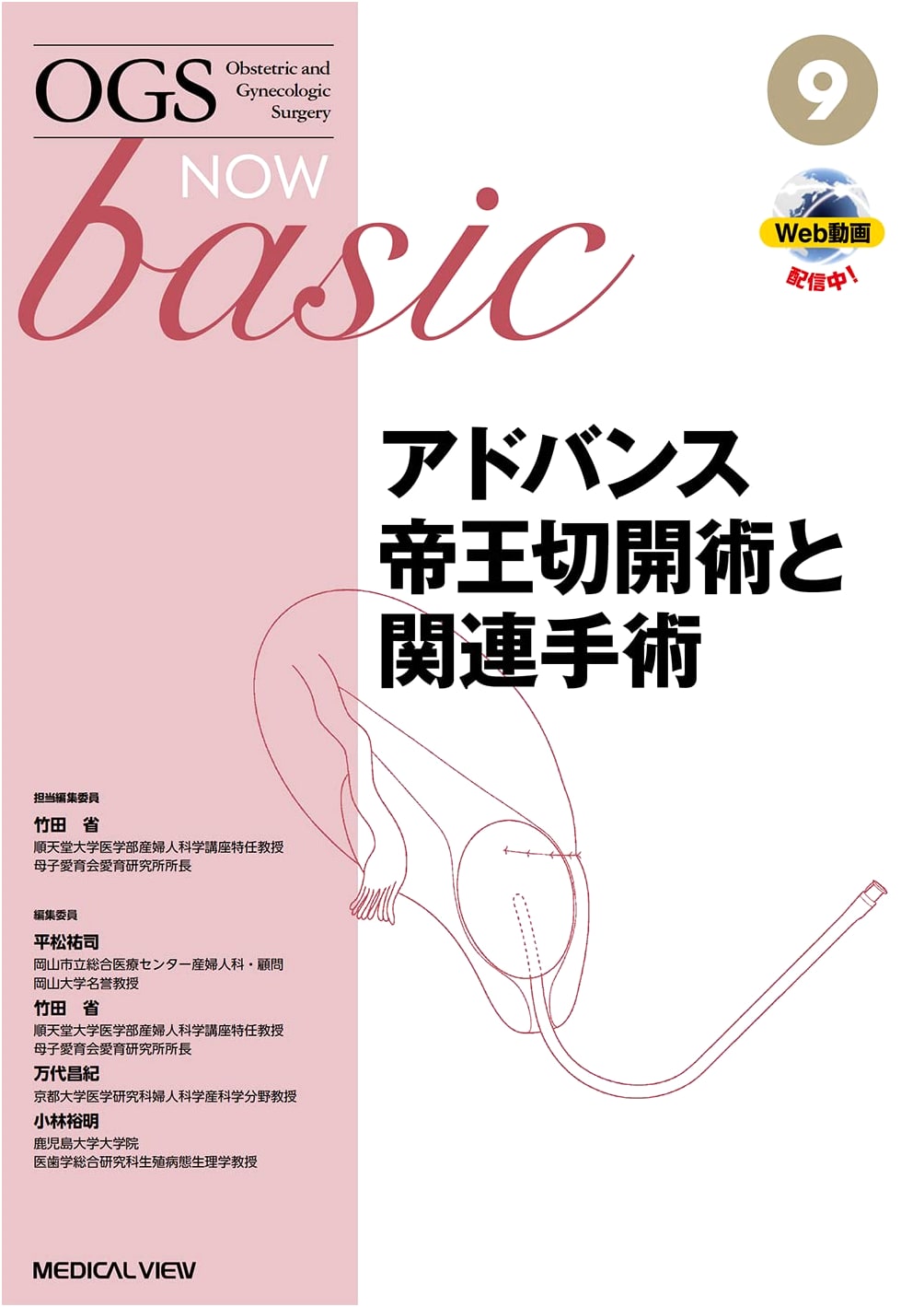 Advanced Cesarean Section and Related Surgery (OGS NOW basic 9)