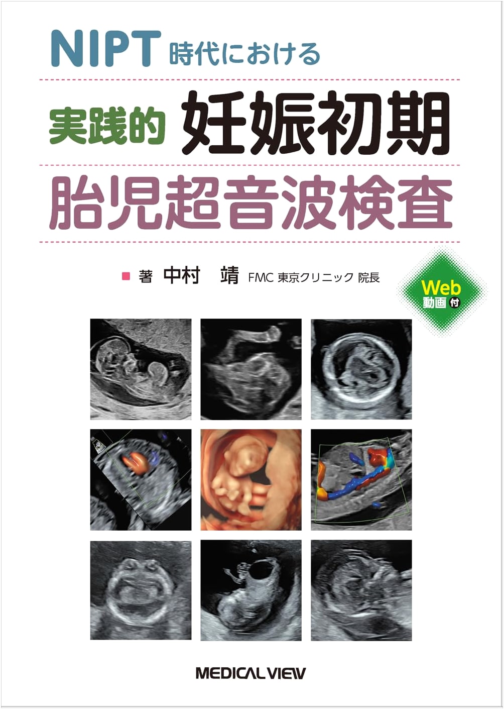 Practical First Trimester Fetal Ultrasound in the NIPT Era by Yasushi Nakamura