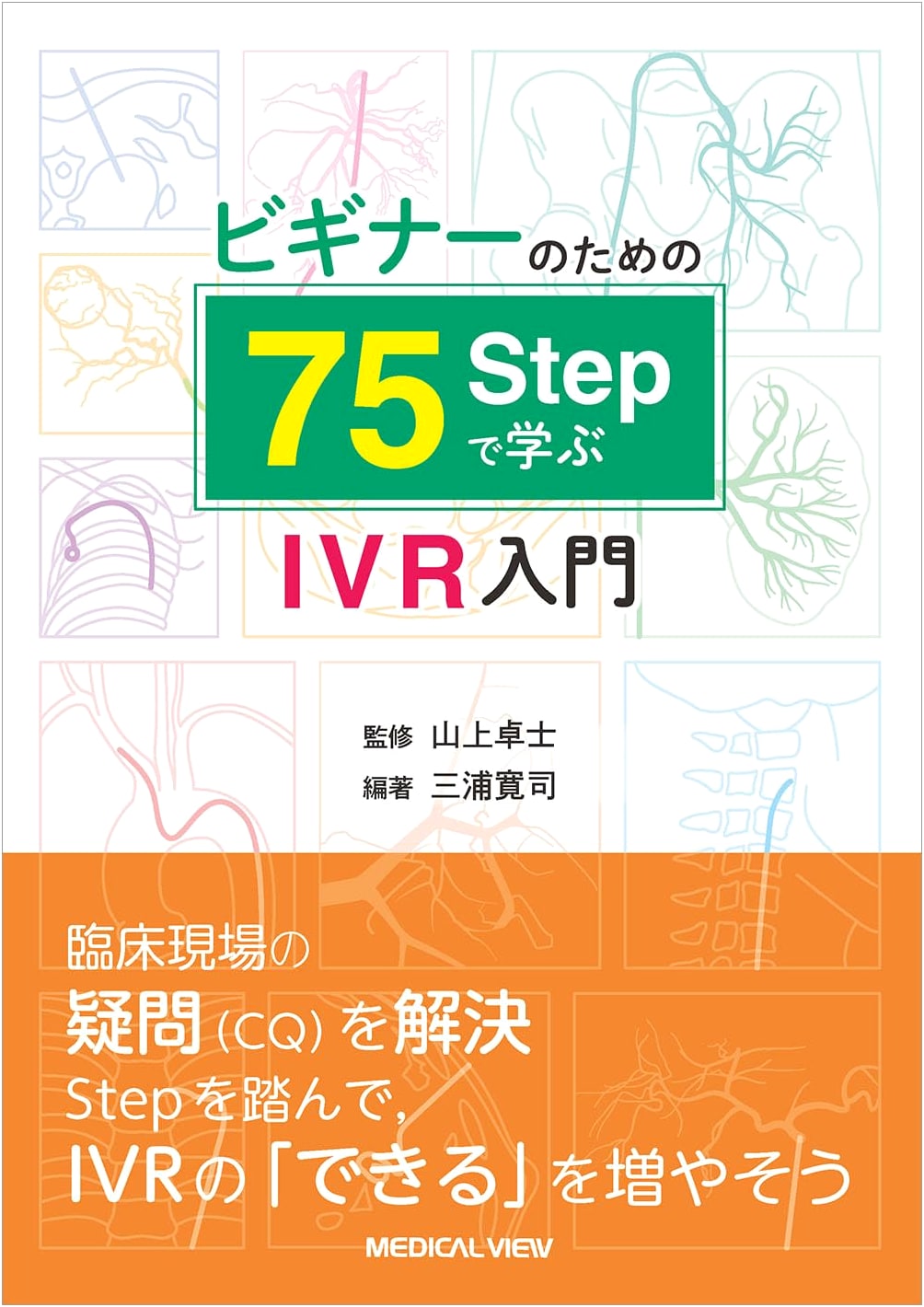 Introduction to IVR: Learn in 75 Steps for Beginners