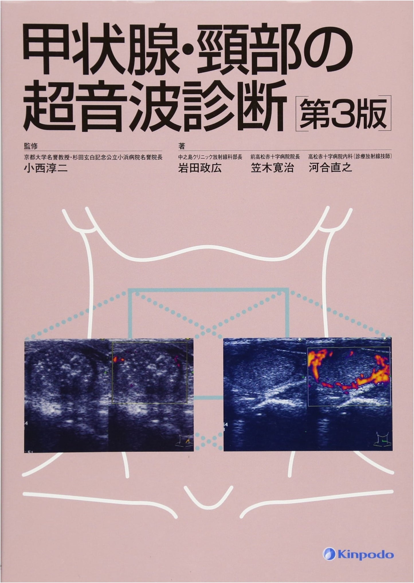 Ultrasound Diagnosis of the Thyroid Gland and Neck