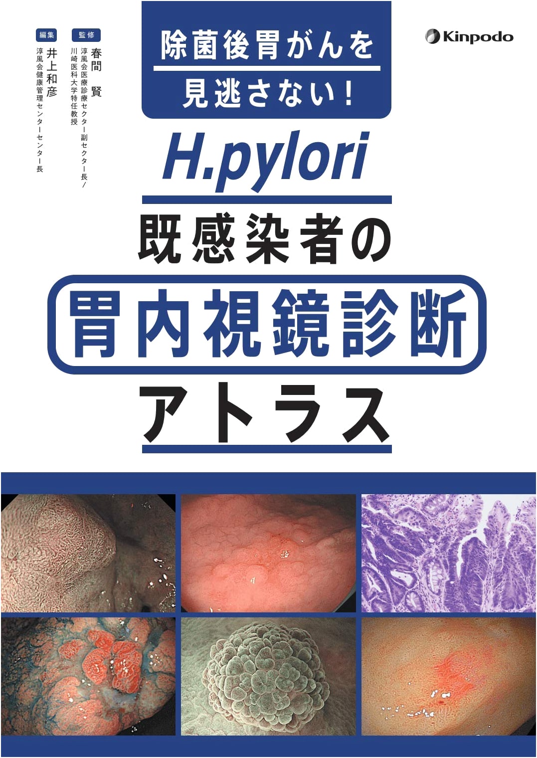 Don't Miss Post-Eradication Gastric Cancer! H. pylori Infection Endoscopic Atlas
