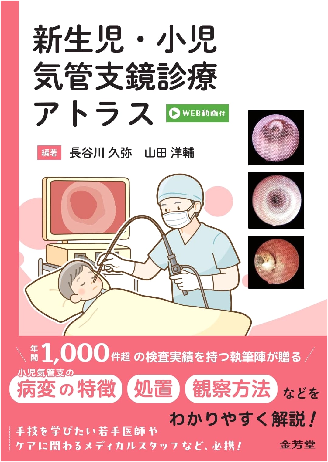 Neonatal & Pediatric Bronchoscopy: A Clinical Atlas with Web Videos