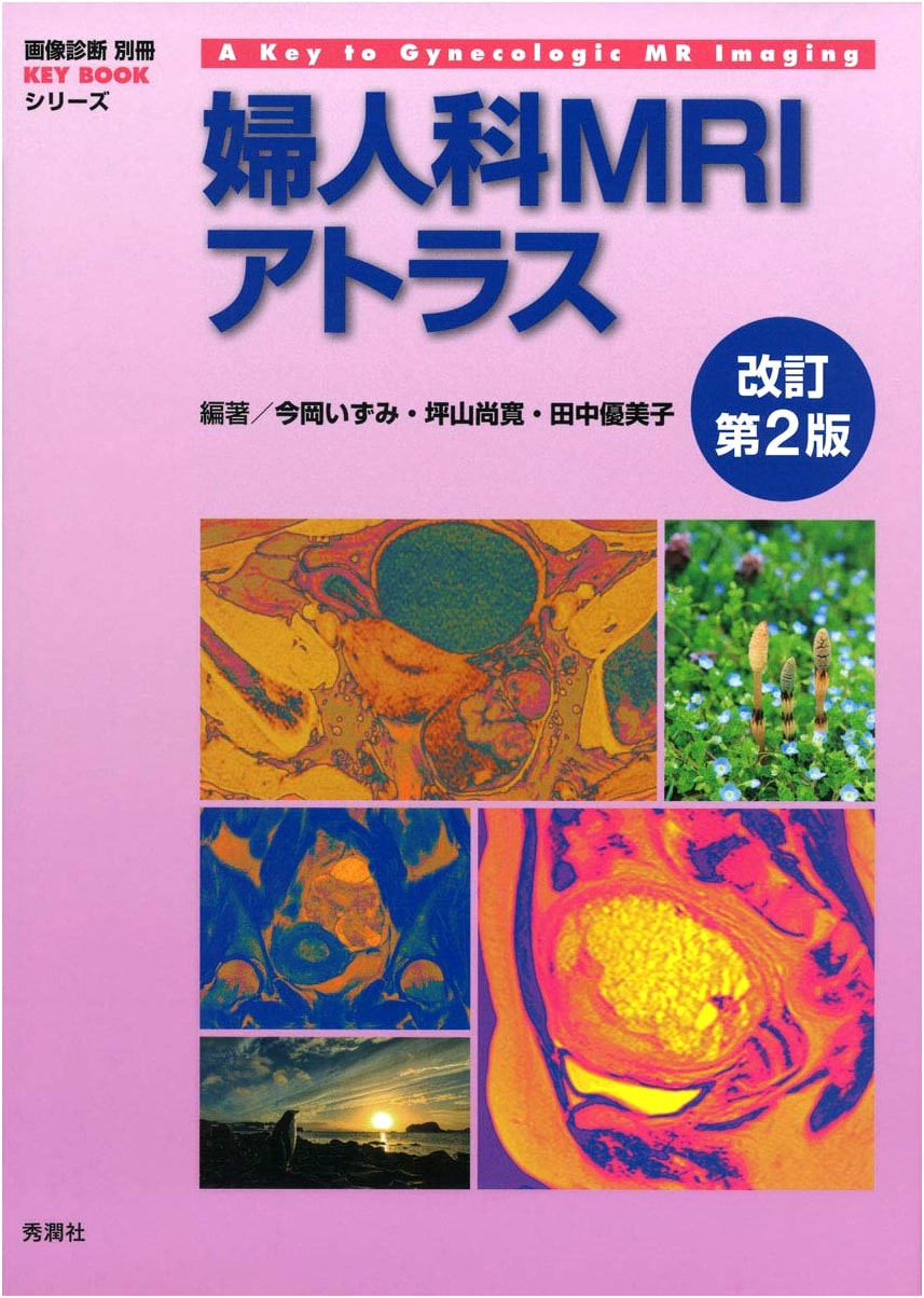 Atlas of Gynecologic MRI, Revised 2nd Edition by Izumi Imaoka