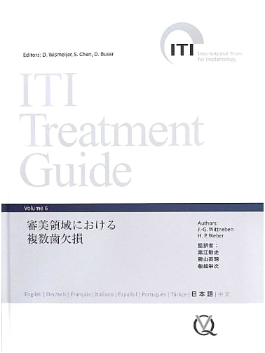 ITI Treatment Guide Volume 6: Multiple Tooth Loss in the Esthetic Zone