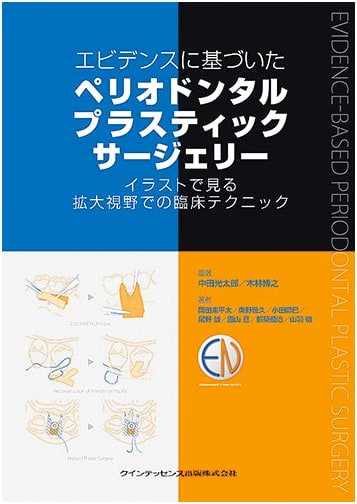Evidence-Based Periodontal Plastic Surgery