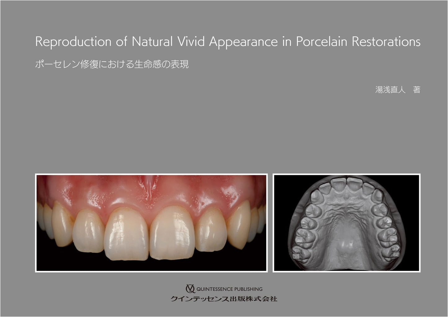 Expressing Life in Porcelain Restoration
