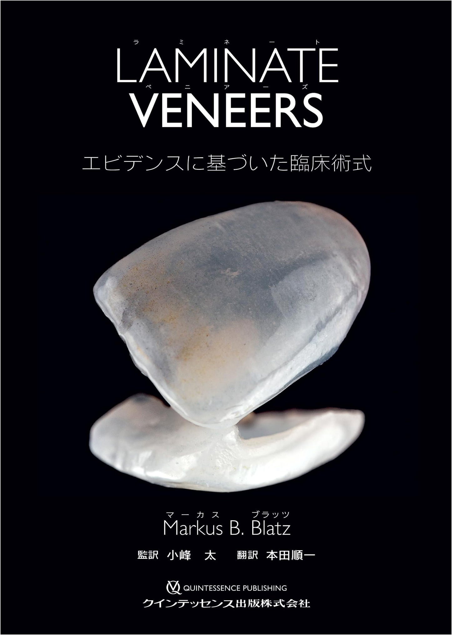 Laminate Veneers: Evidence-Based Clinical Procedures