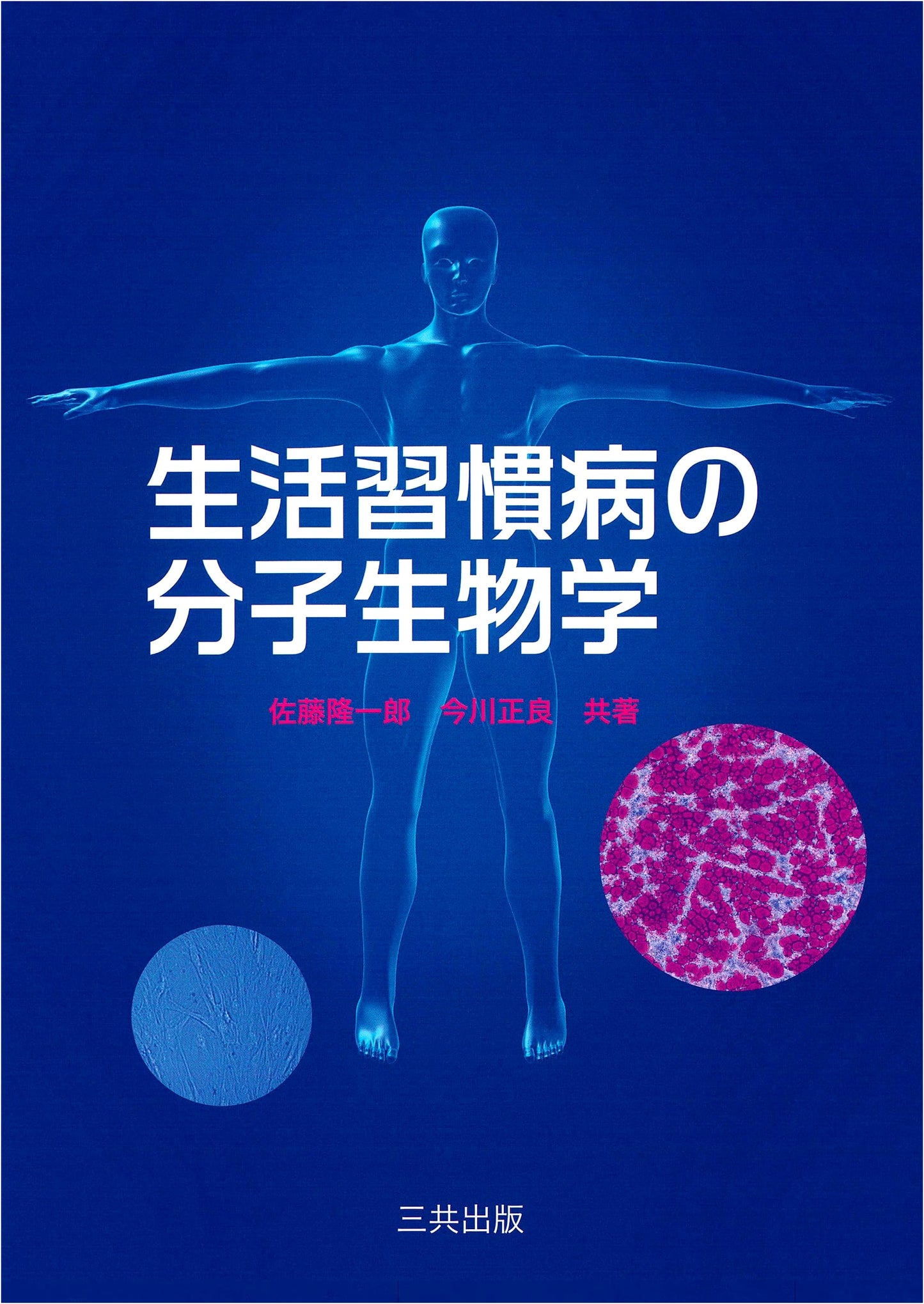 Molecular Biology of Lifestyle Diseases