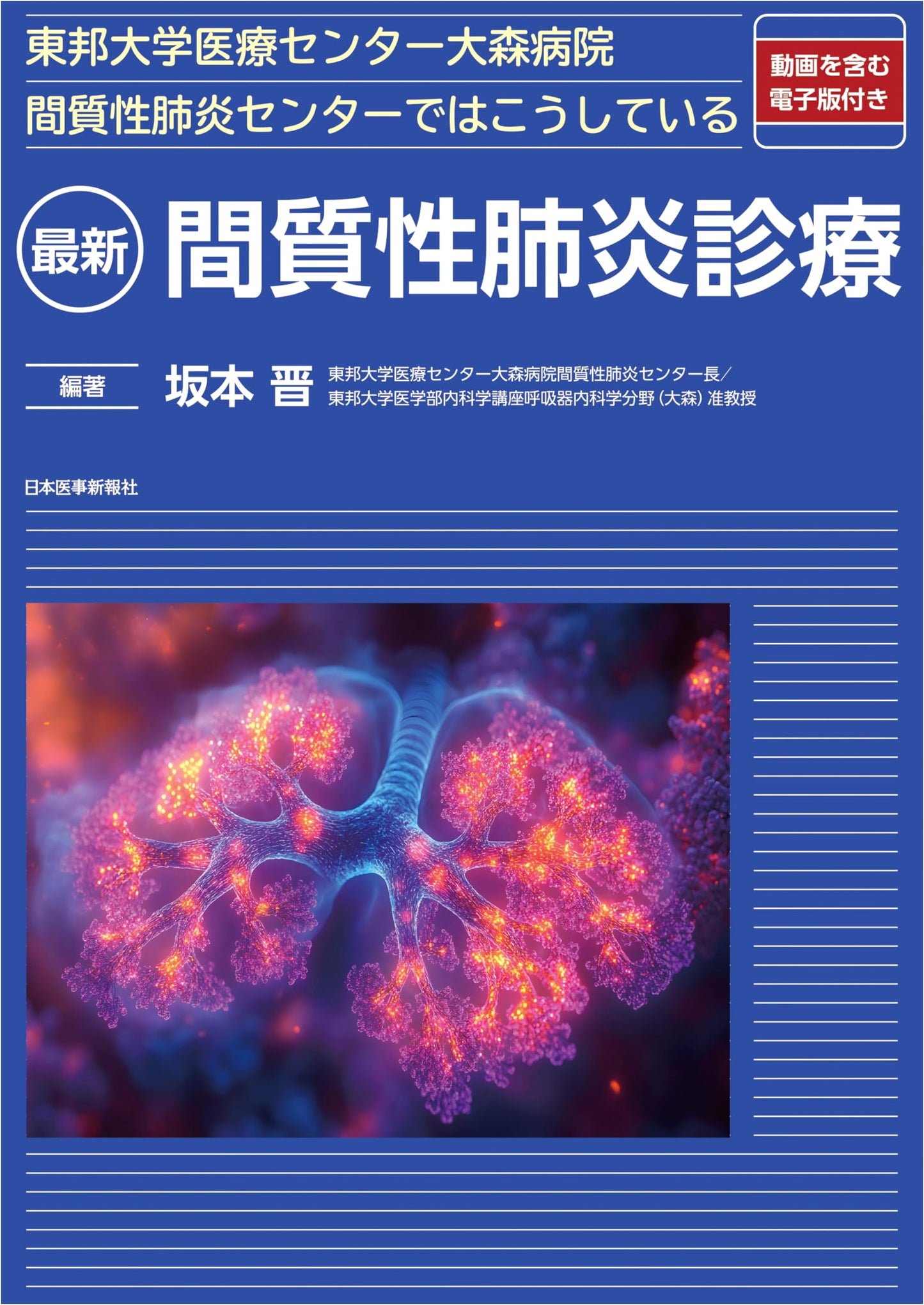 Toho University Medical Center Omori Hospital: Latest Interstitial Pneumonia Treatment