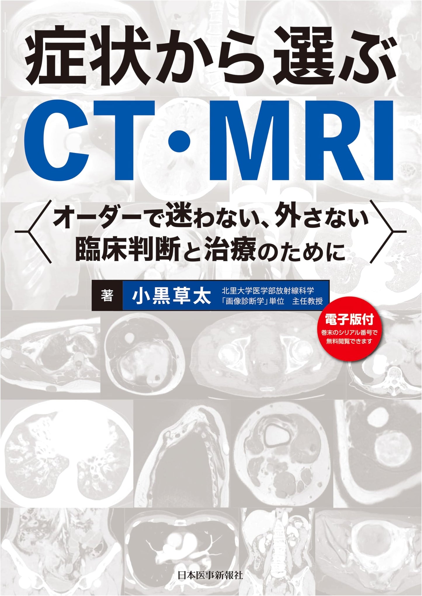 Symptom-Based CT & MRI Selection Guide for Medical Professionals