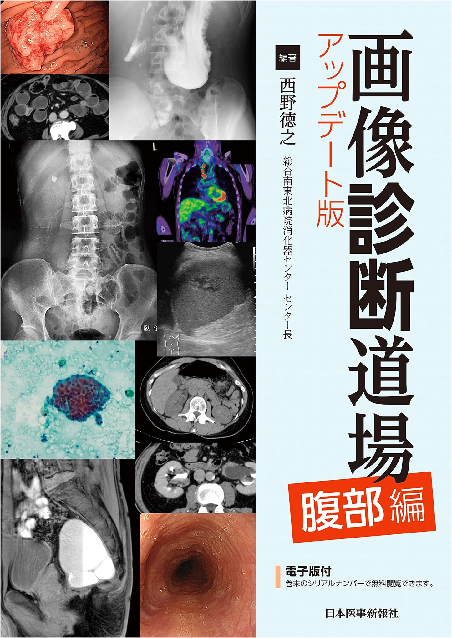 Diagnostic Imaging Dojo: Abdominal Volume - Updated Edition