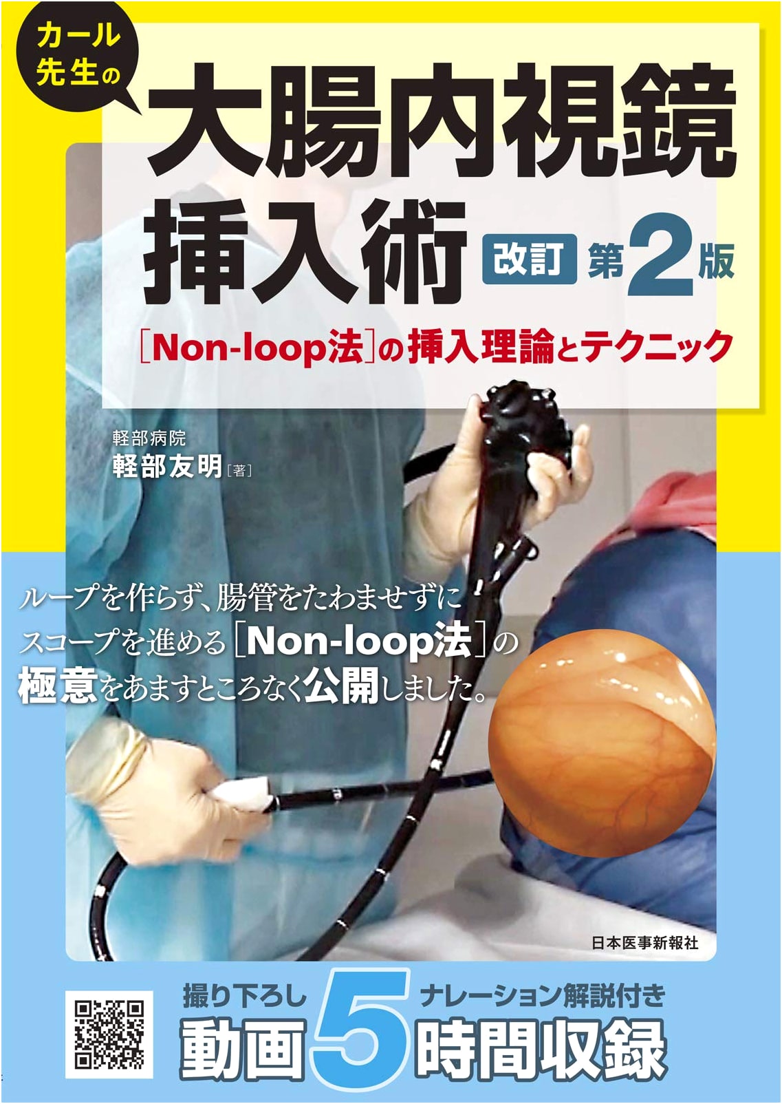 Dr. Karl's Colonoscopy: Non-Loop Insertion Theory & Techniques, 2nd Ed.