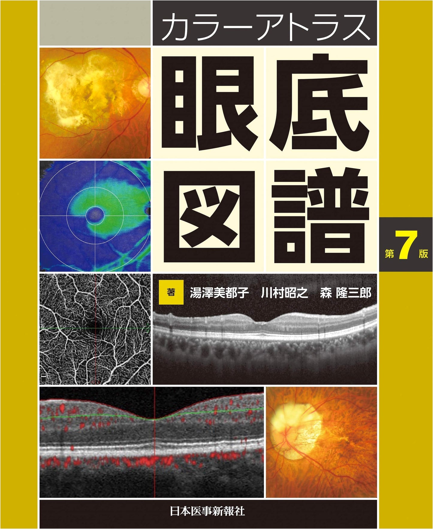 Color Atlas of the Ocular Fundus