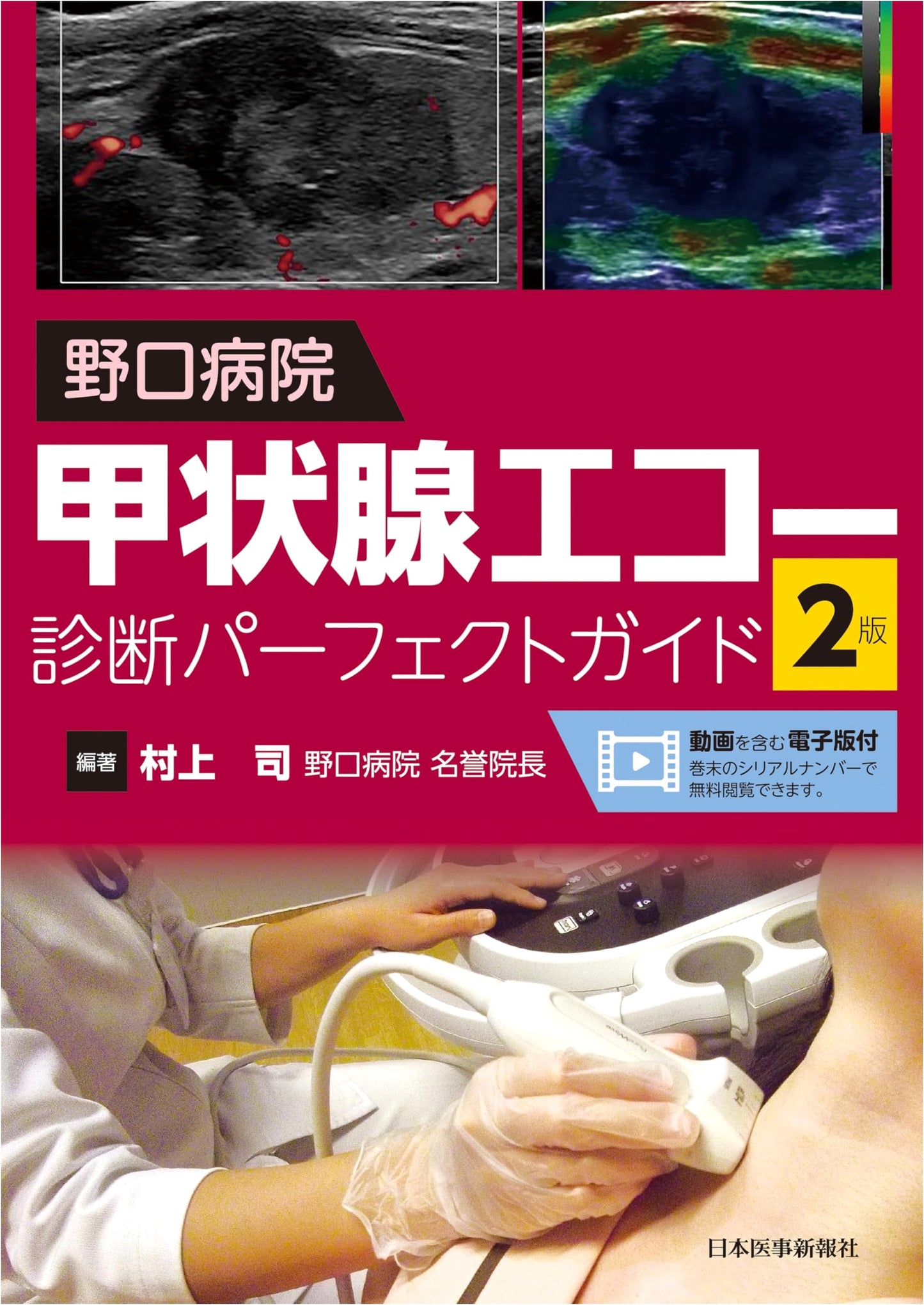 Noguchi Hospital Thyroid Ultrasound Diagnosis Perfect Guide, 2nd Edition