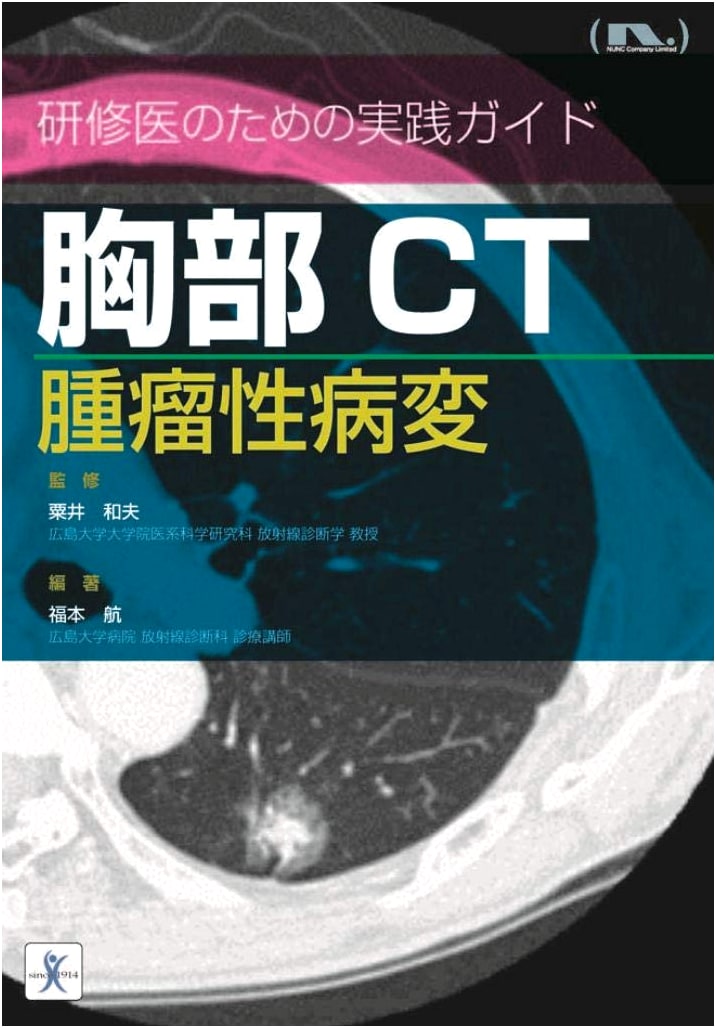 Chest CT Tumorous Lesions: A Practical Guide for Residents