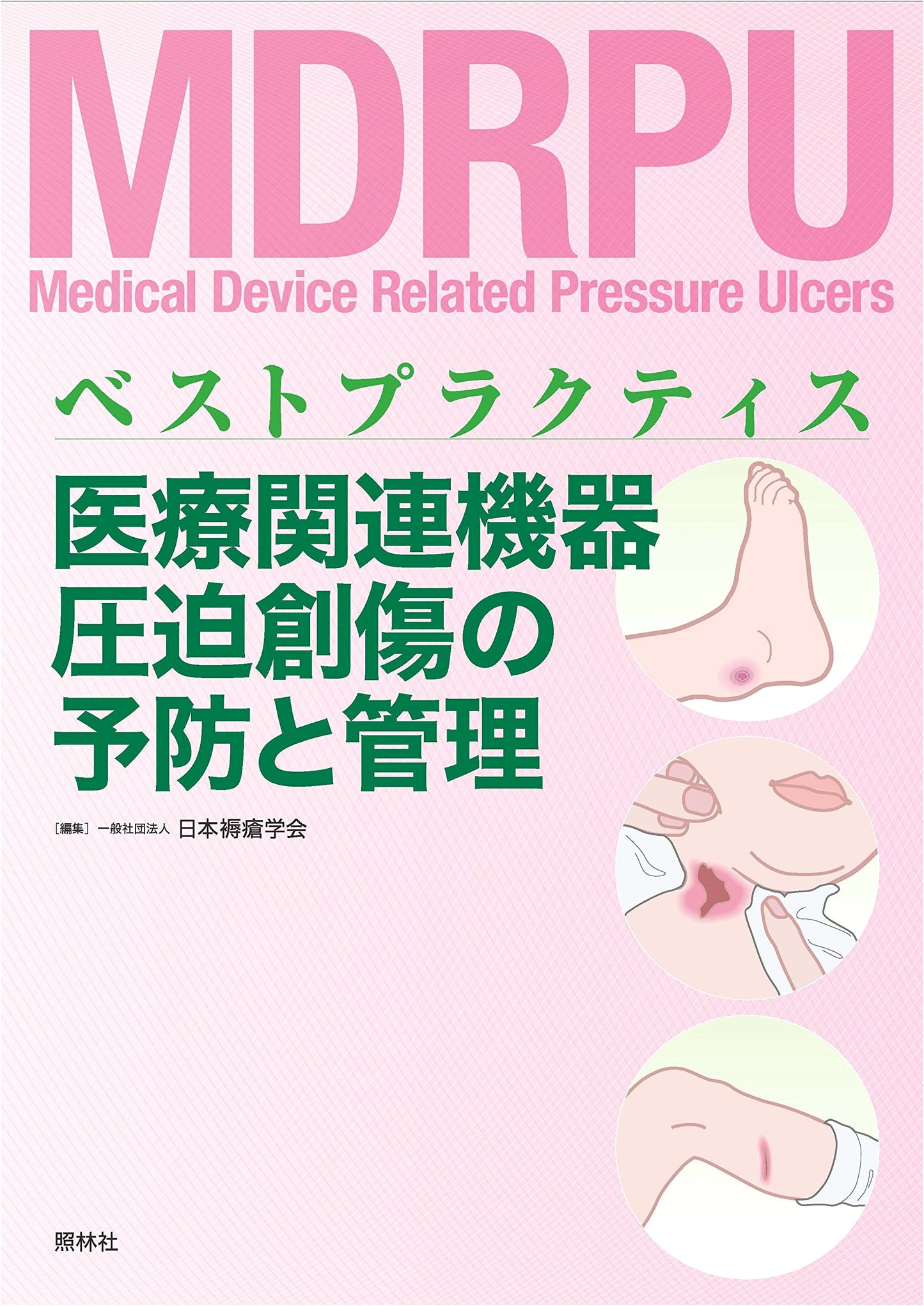 Preventing and Managing Medical Device-Related Pressure Injuries: Best Practices