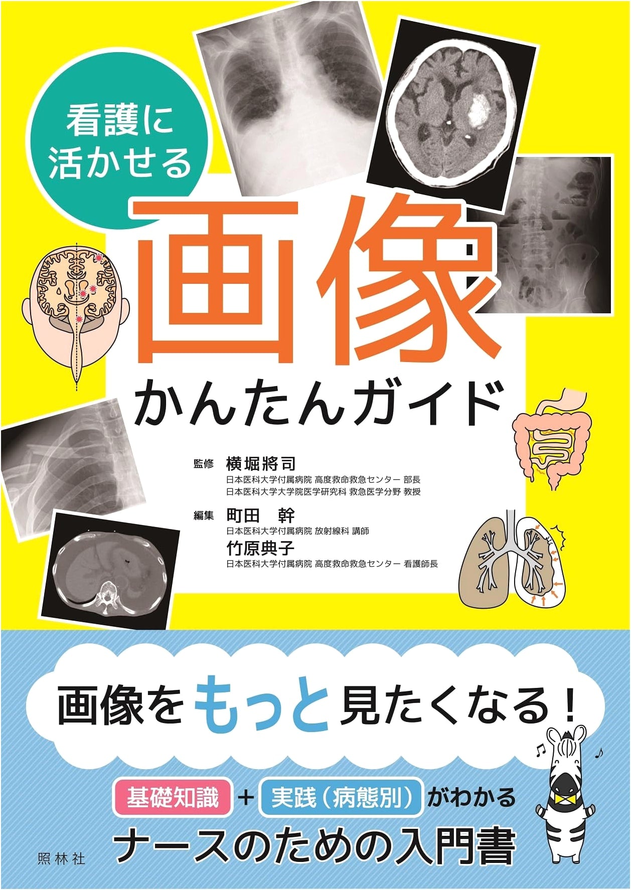 Simple Guide to Medical Imaging for Nursing Practice