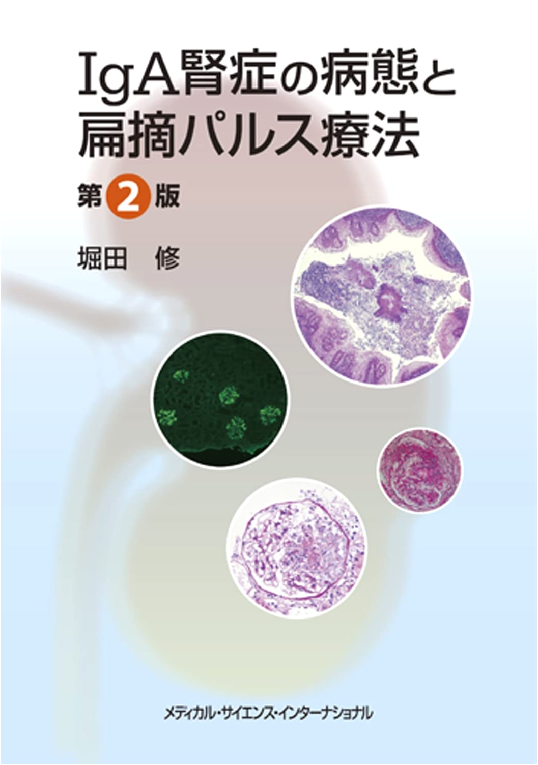 Pathology and Tonsillectomy Pulse Therapy for IgA Nephropathy, 2nd Edition