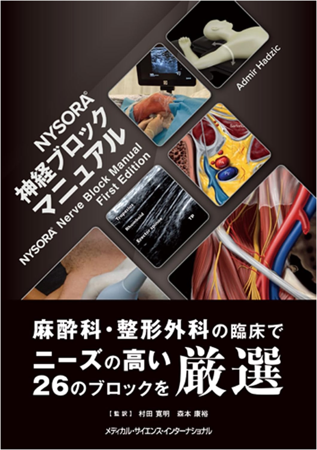 NYSORA© Nerve Block Manual