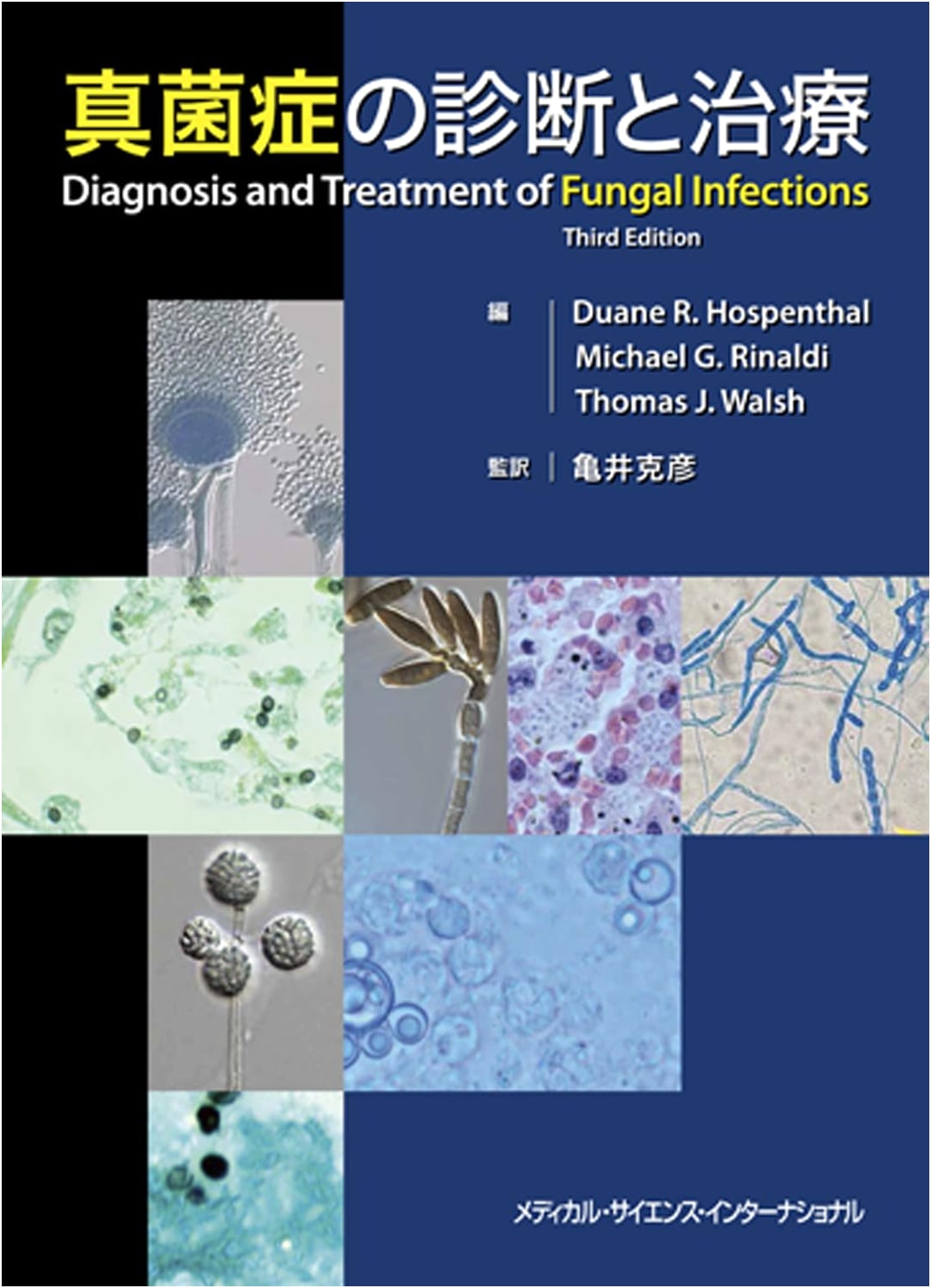 Diagnosis and Treatment of Fungal Infections