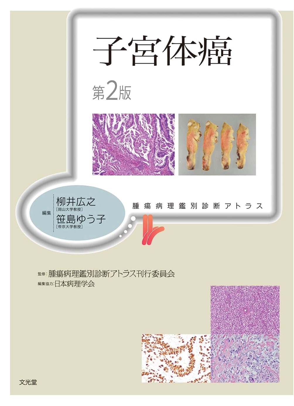 Endometrial Carcinoma, 2nd Edition: Differential Diagnosis Atlas of Tumor Pathology