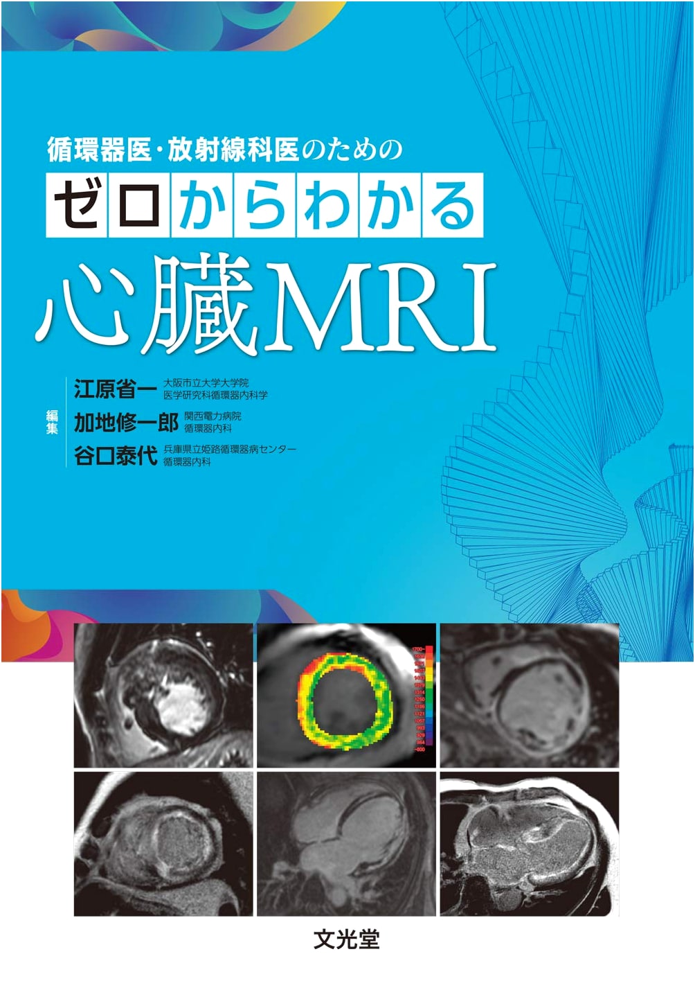 Cardiac MRI: A Beginner's Guide for Cardiologists and Radiologists