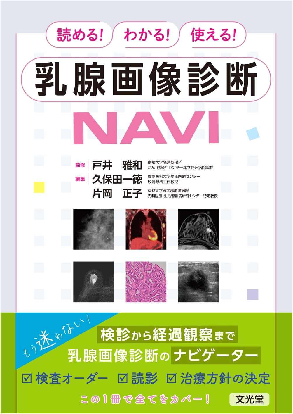 Breast Imaging Diagnosis NAVI: A Readable, Understandable, and Usable Guide