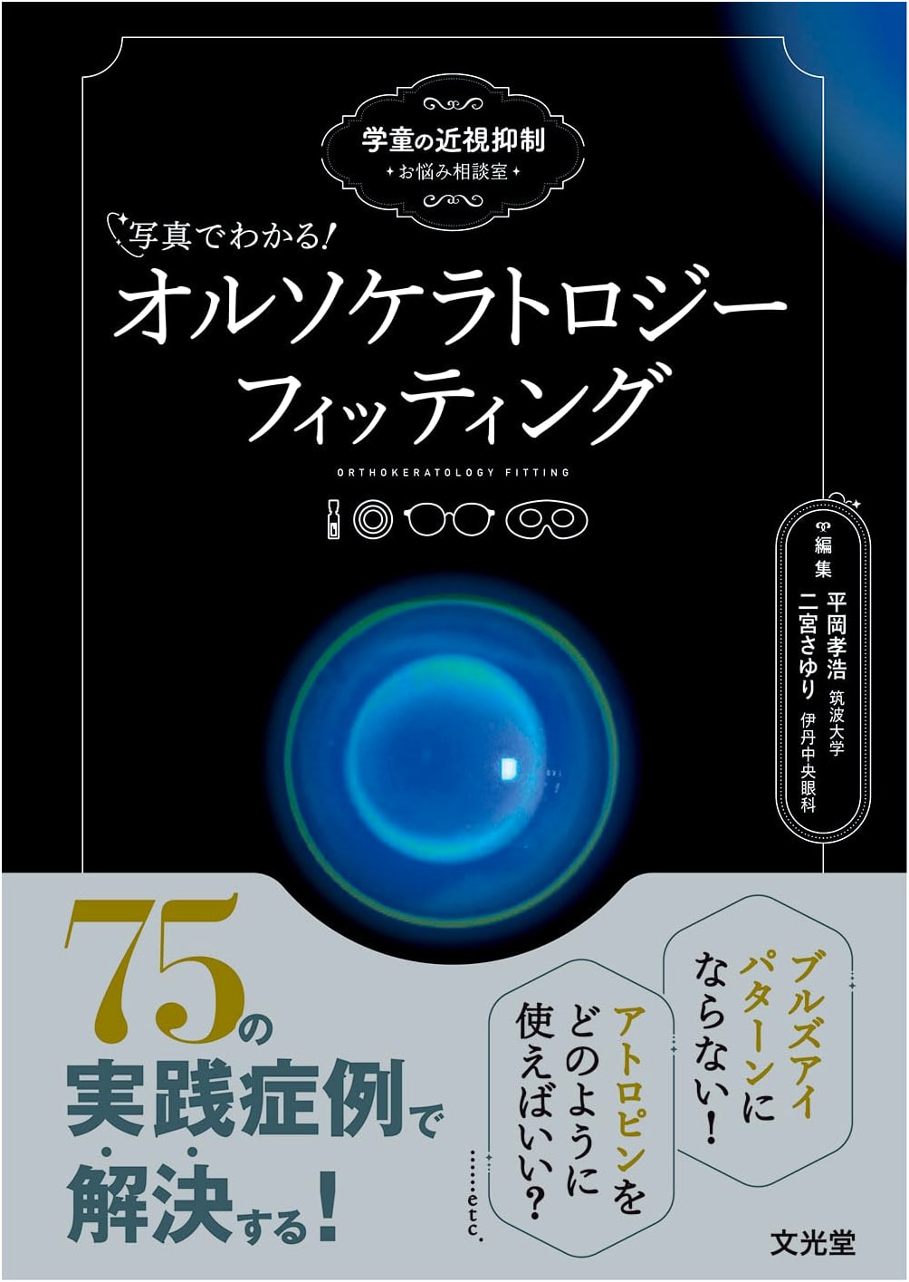 Illustrated Guide to Orthokeratology Fitting: Myopia Control Consultation for Schoolchildren