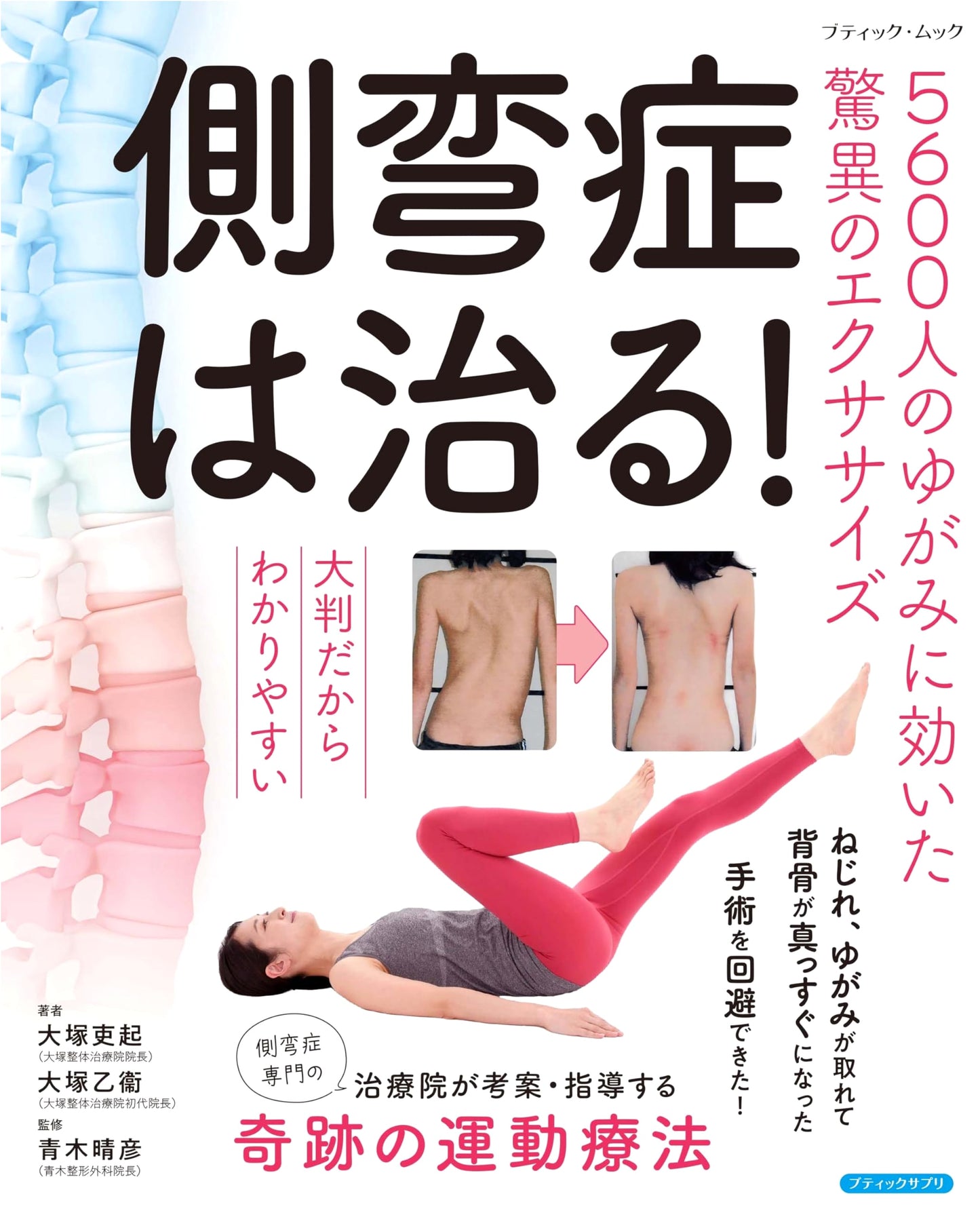 Scoliosis Can Be Cured! Amazing Exercises Effective for 5600 People's Distortions