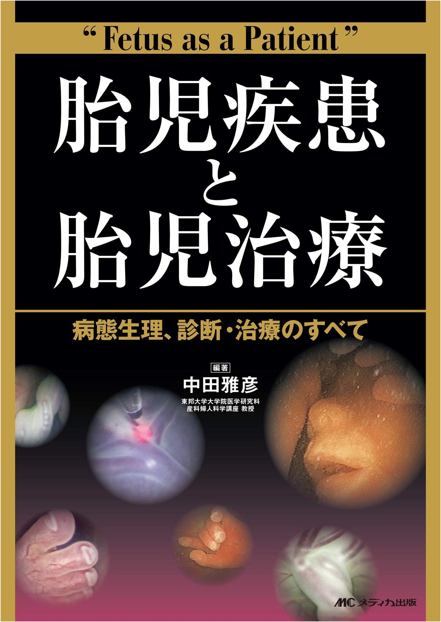 Fetal Disease and Therapy: Pathophysiology, Diagnosis, and Treatment by Masahiko Nakata