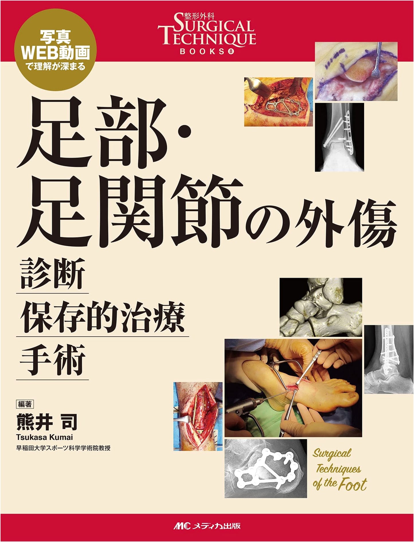 Foot and Ankle Trauma: Diagnosis, Conservative Treatment, Surgery