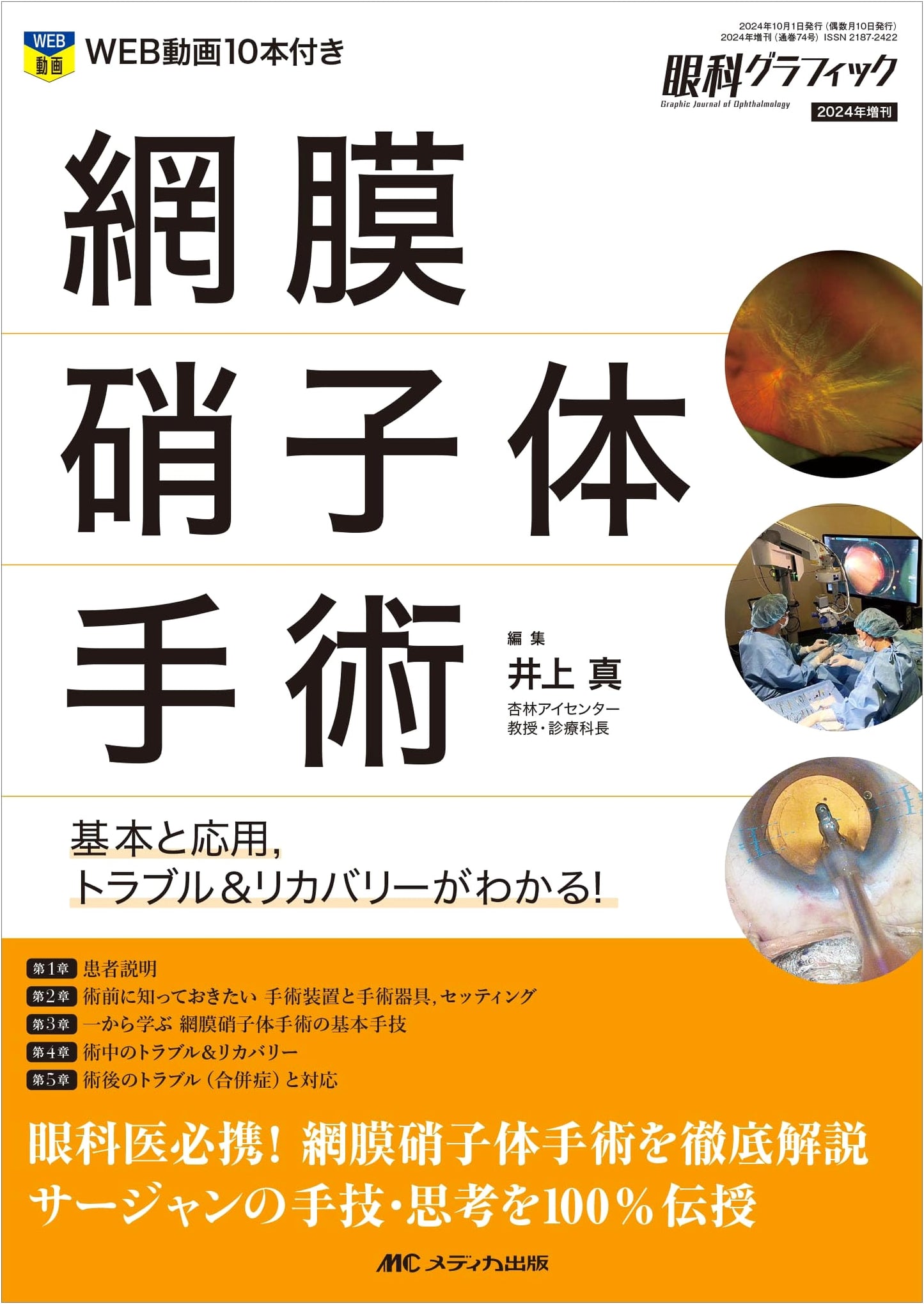 Retinal & Vitreous Surgery: Fundamentals, Applications, Troubleshooting & Recovery (Ophthalmology Graphic 2024 Special Issue)