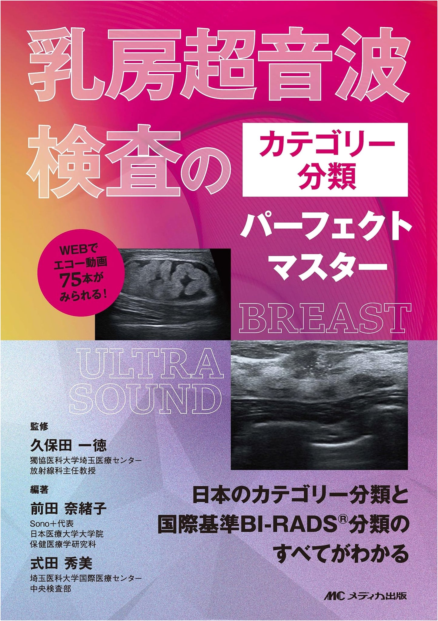Perfect Master of Breast Ultrasound Category Classification: Japan's & International BI-RADS(R) Standard