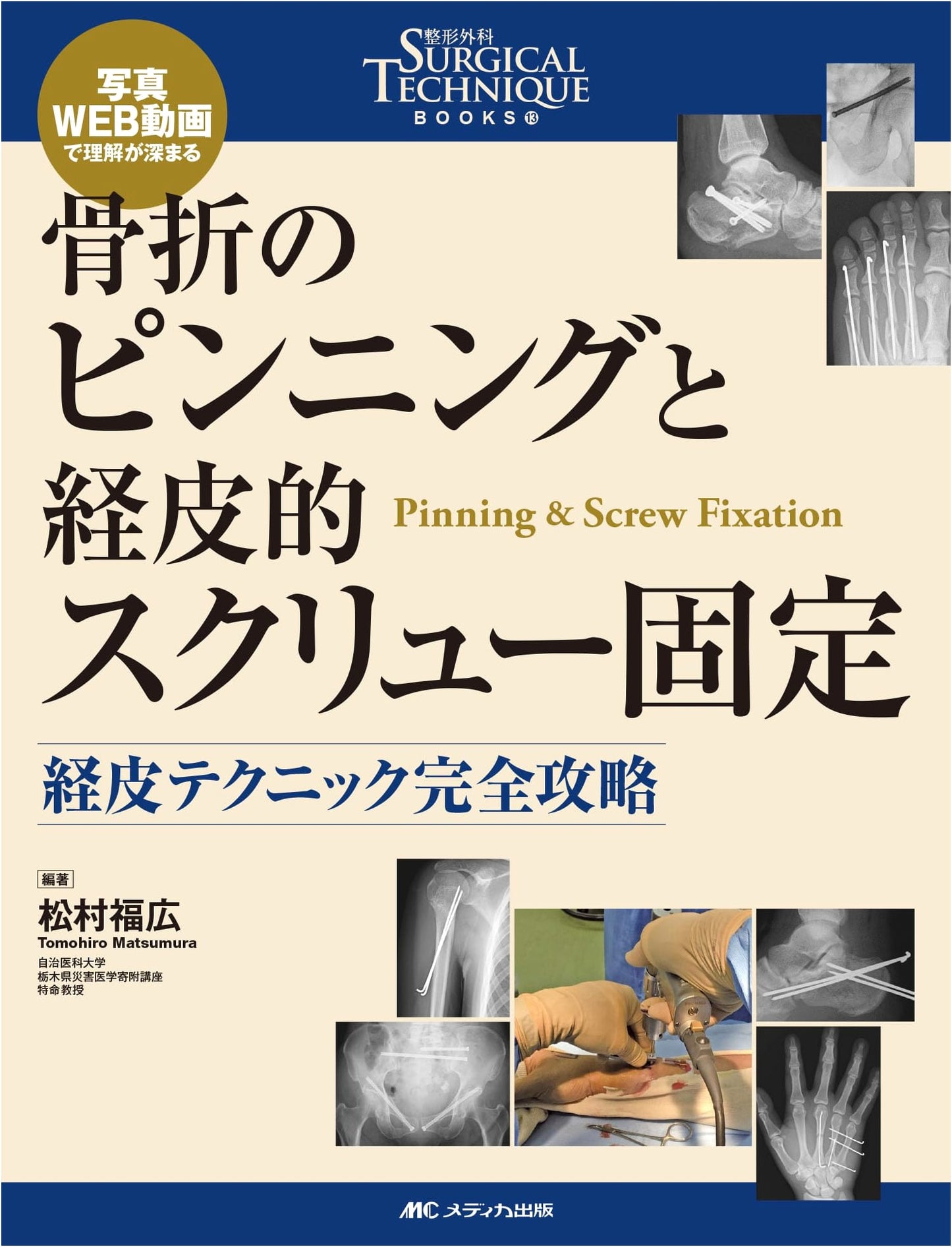 Mastering Percutaneous Techniques: Fracture Pinning & Screw Fixation (Orthopedic Surgical Technique 13)