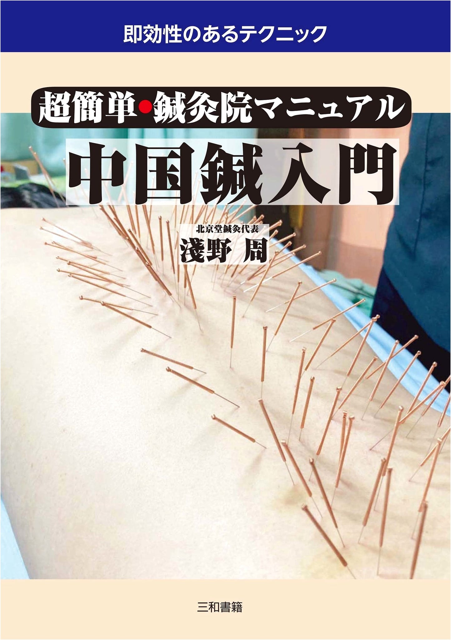 Super Easy Acupuncture Clinic Manual: Introduction to Chinese Acupuncture