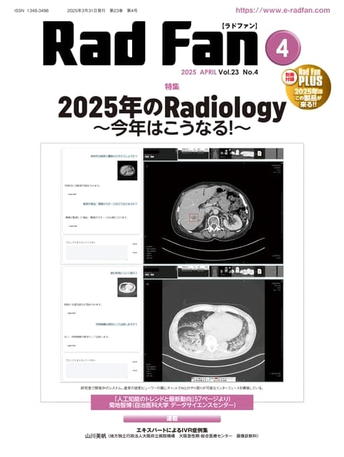 RadFan April 2025 Issue