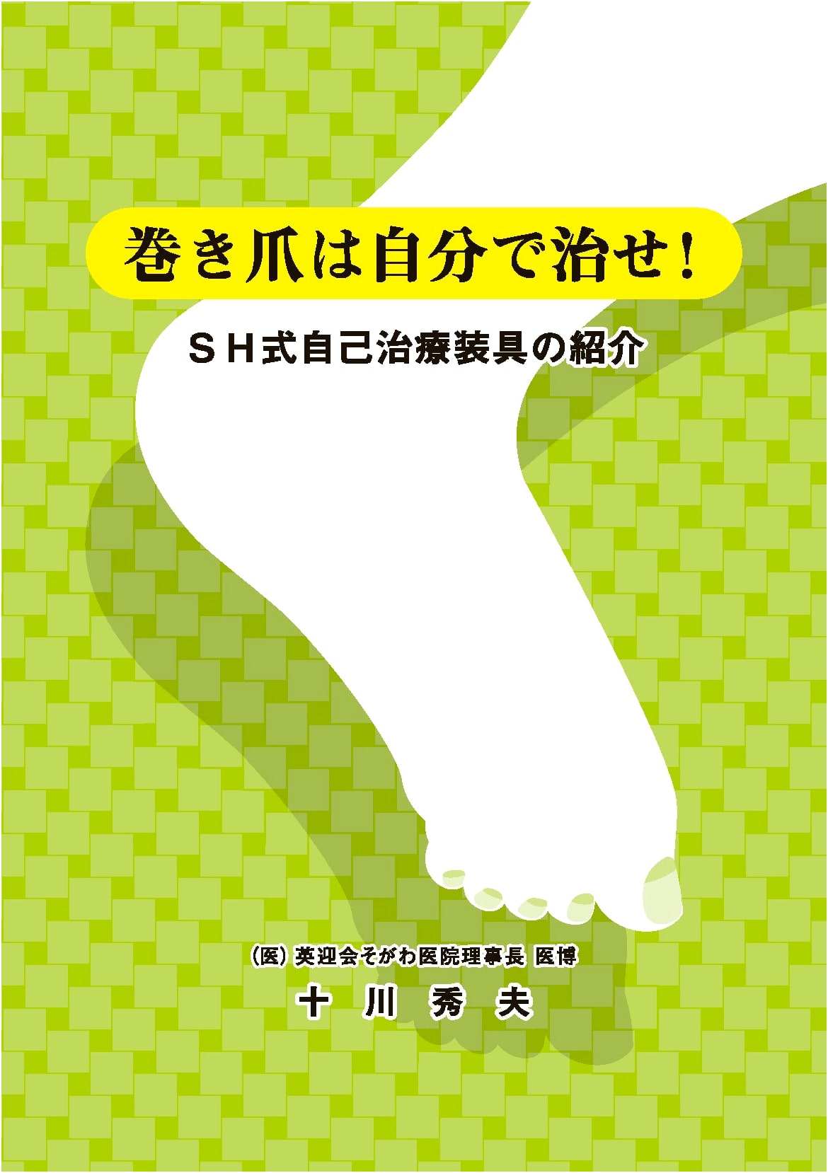 Fix Your Ingrown Toenails Yourself! Introduction to the SH Self-Treatment Brace