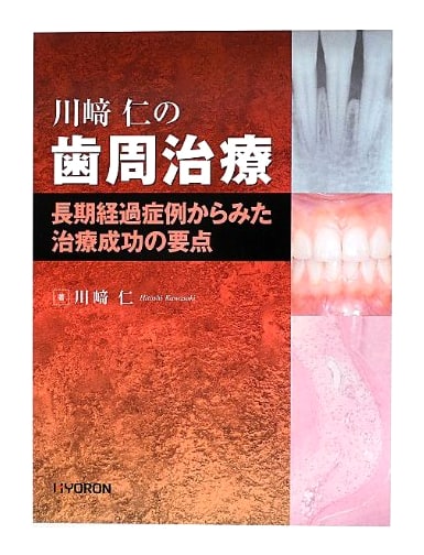 Hitoshi Kawasaki's Periodontal Treatment: Keys to Success from Long-Term Cases