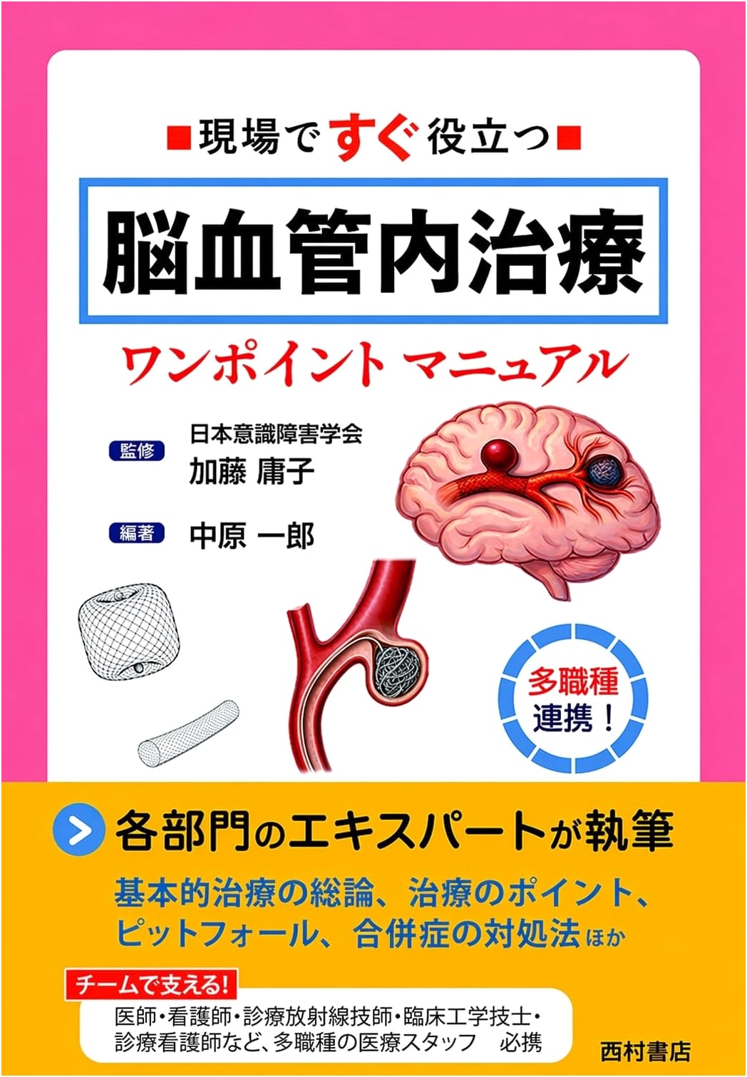 Practical On-Site Manual: Cerebrovascular Endovascular Treatment One-Point Guide