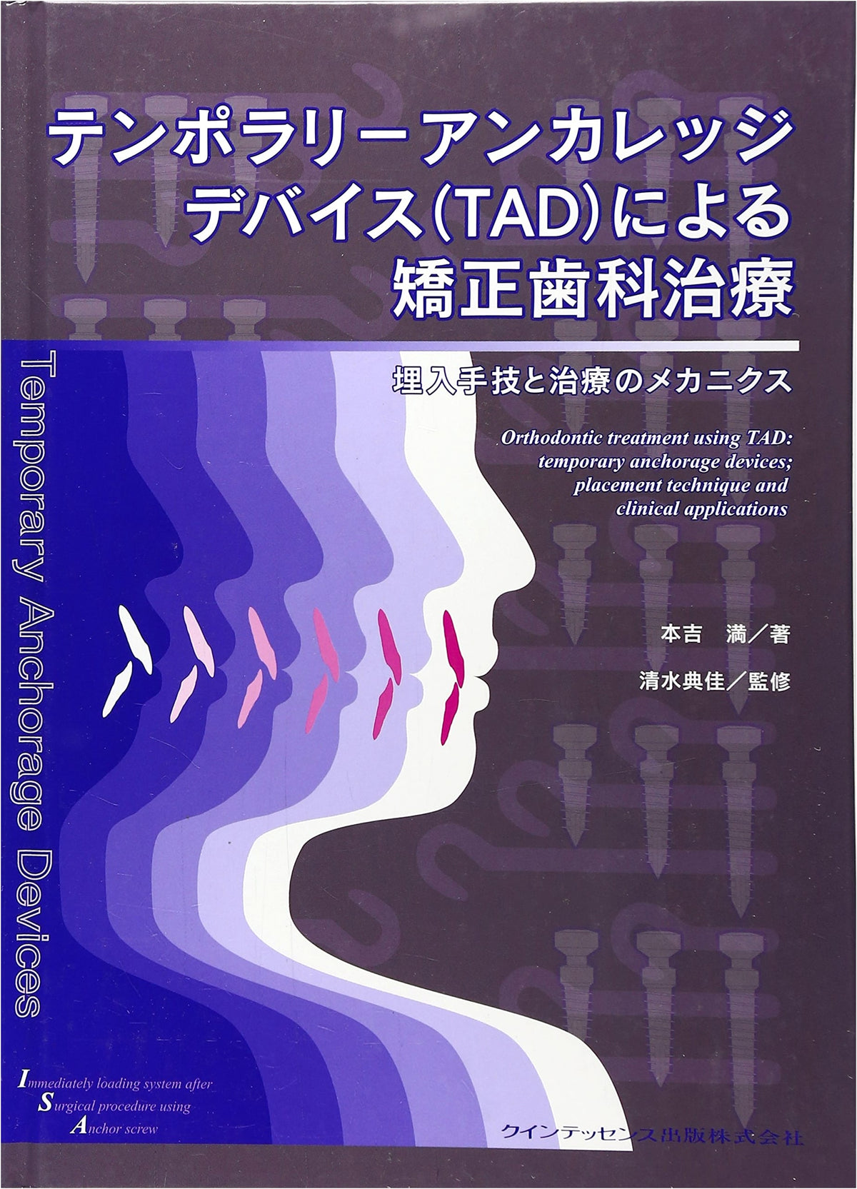 Orthodontic Treatment with Temporary Anchorage Devices (TADs): Implantation and Mechanics