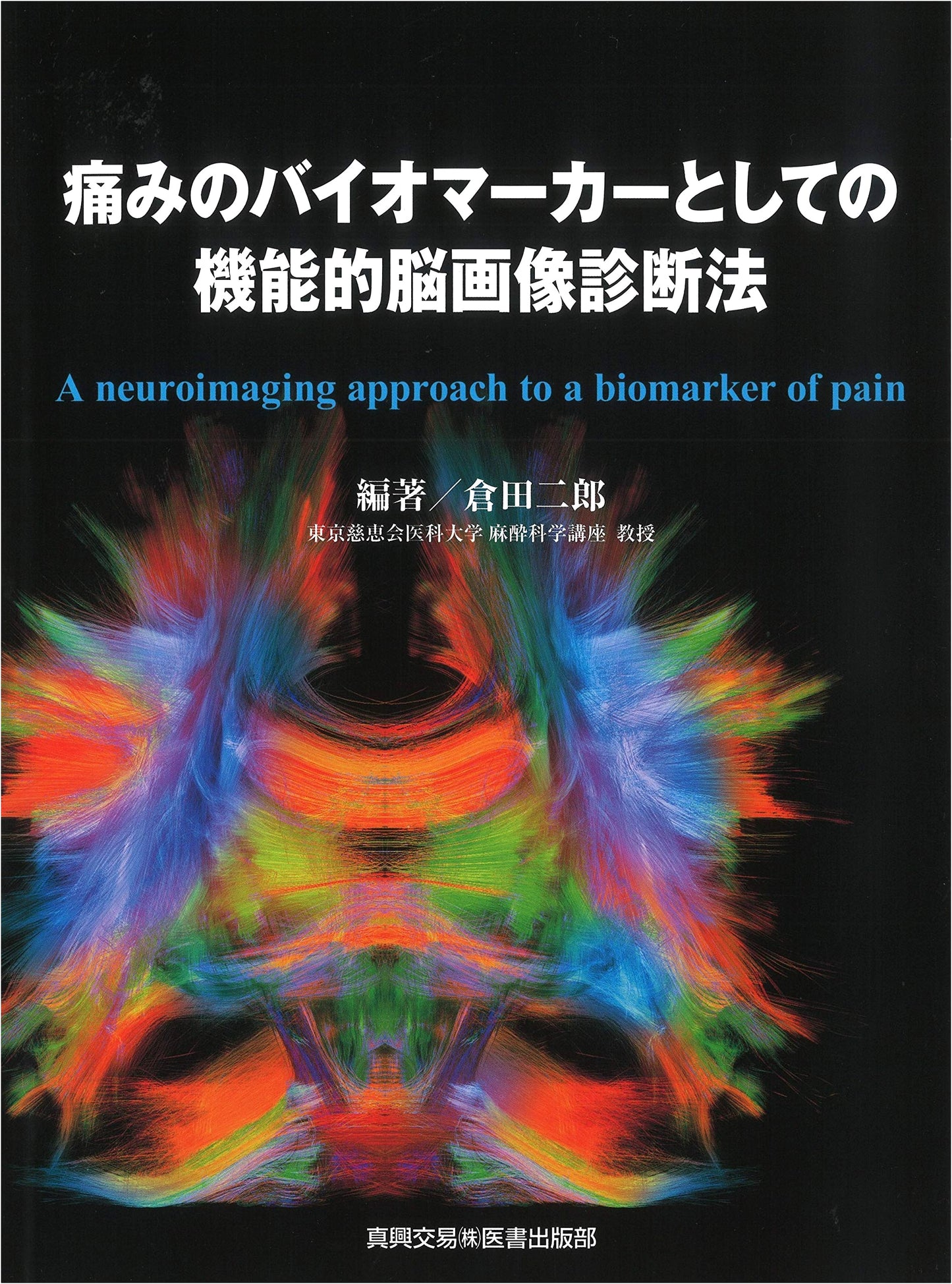 Functional Neuroimaging as a Biomarker for Pain