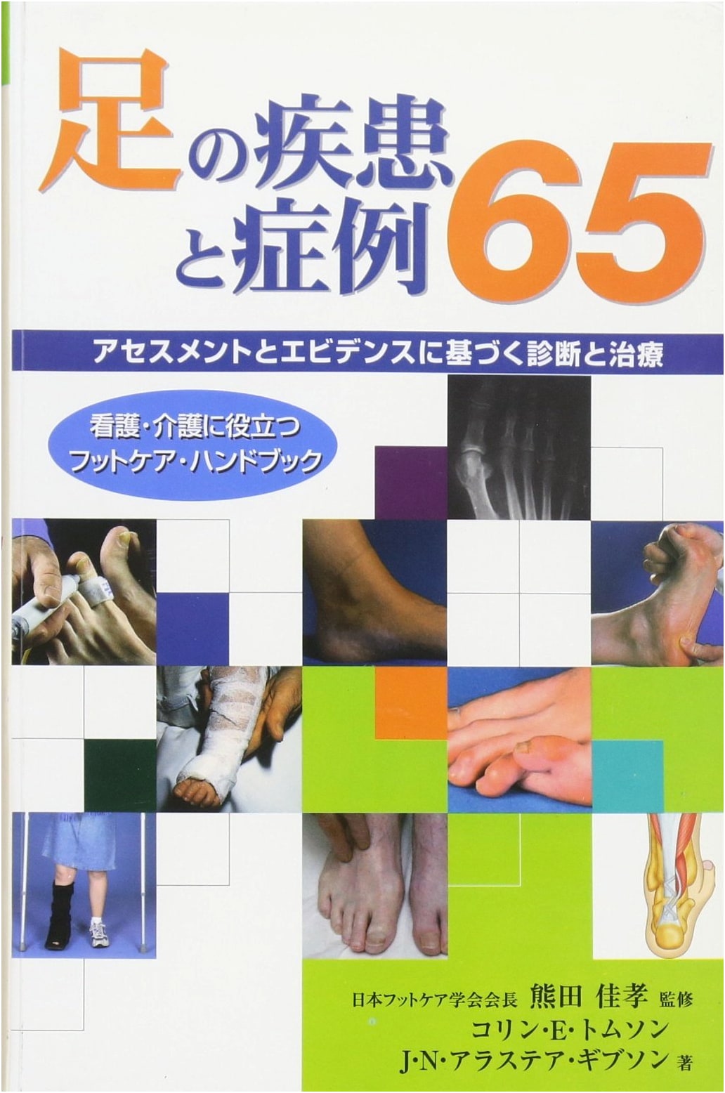 65 Foot Diseases & Case Studies: A Handbook for Nursing & Care Foot Care (GAIA BOOKS)