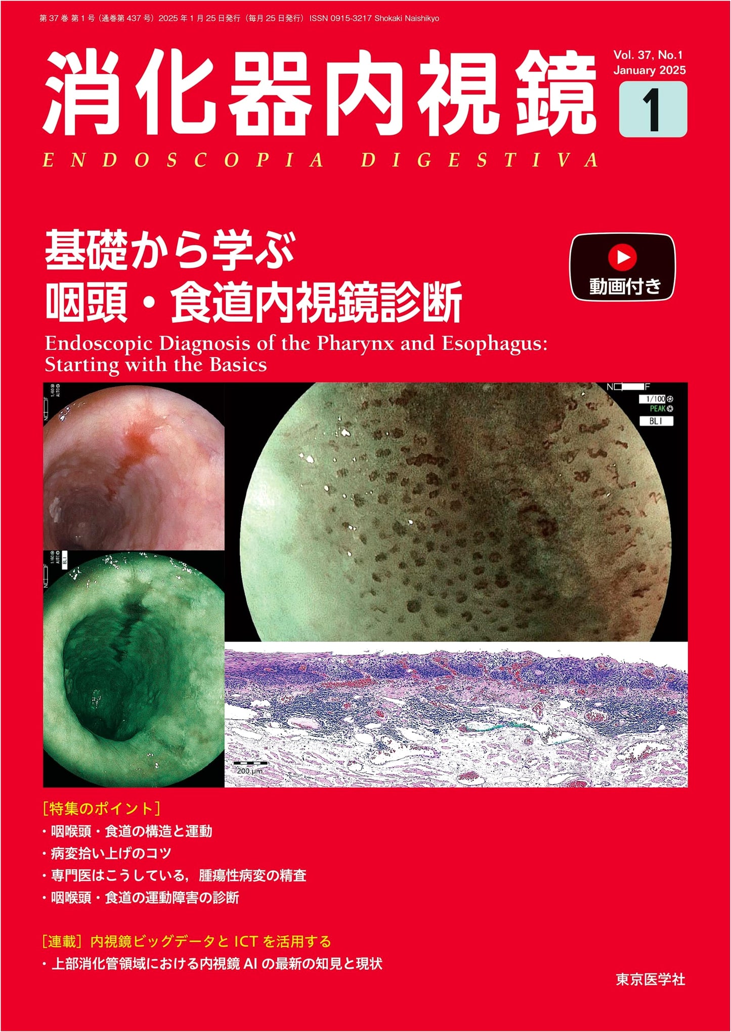 Gastrointestinal Endoscopy Vol. 37, No. 1, January 2025: Pharynx & Esophagus Diagnosis