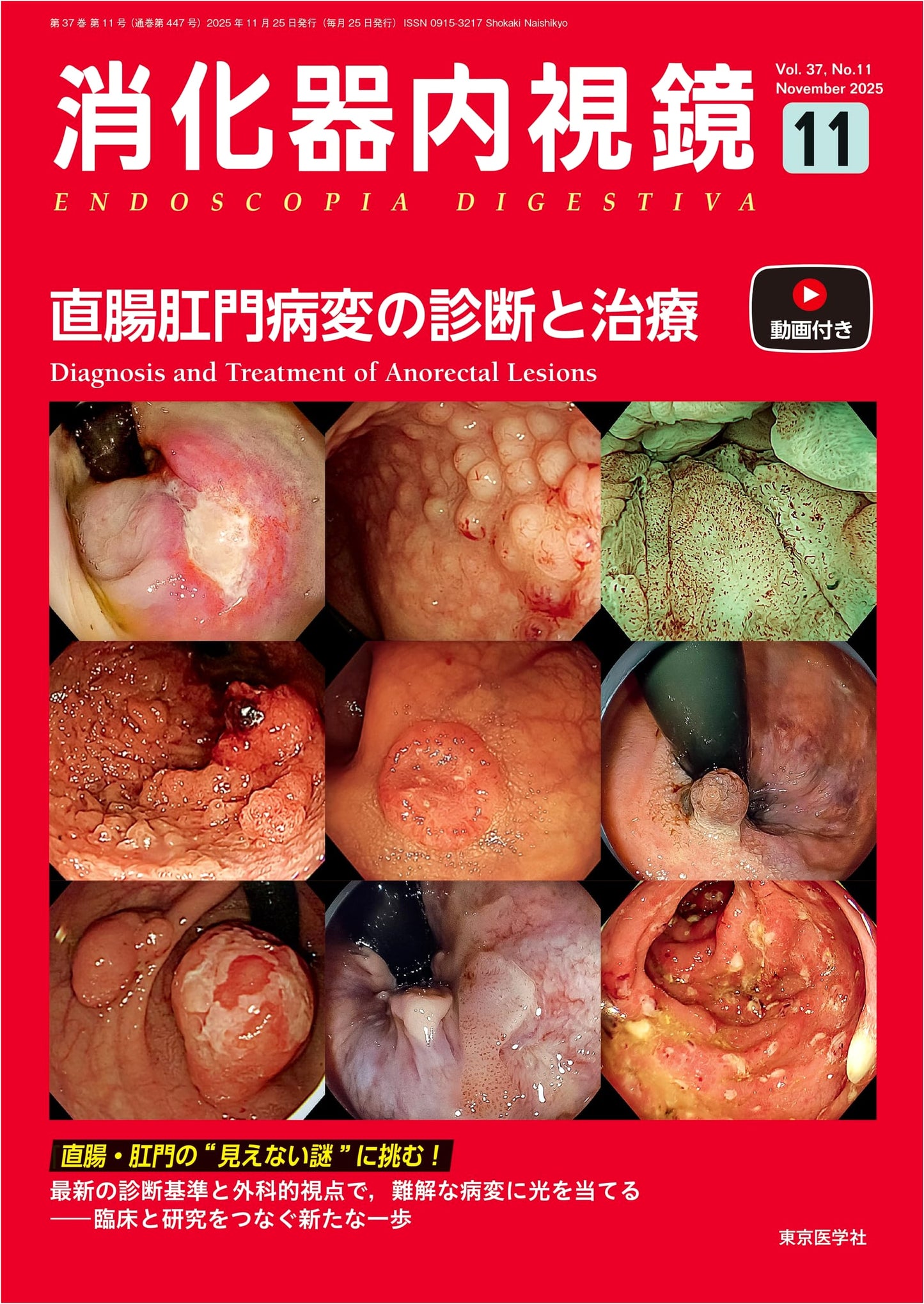 Gastrointestinal Endoscopy Vol. 37, No. 11 (November 2025): Diagnosis and Treatment of Rectal and Anal Lesions