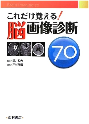 Mastering Brain Imaging Diagnosis: 70 Essential Points