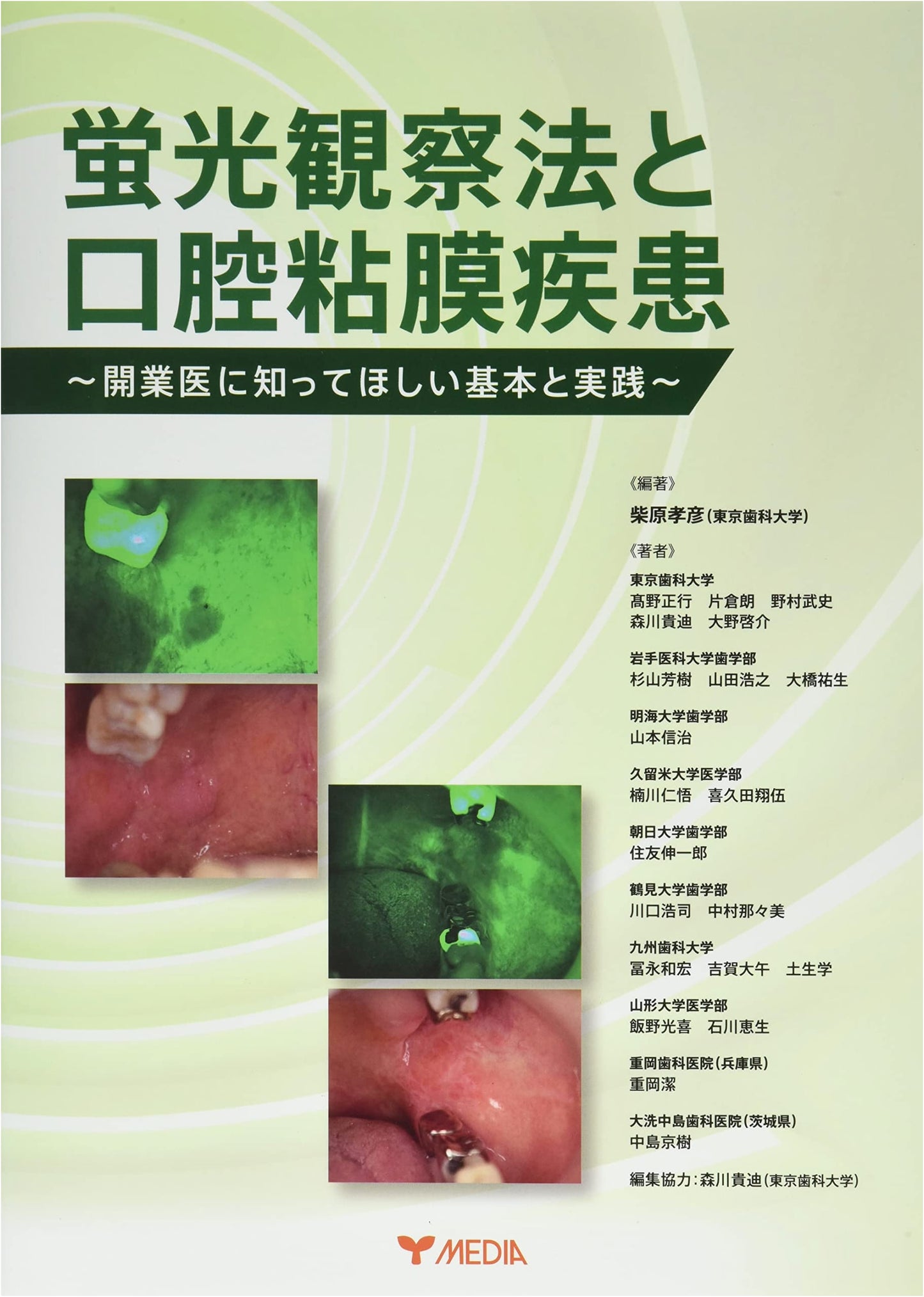 Fluorescence Observation Methods and Oral Mucosal Diseases: Fundamentals for Clinicians