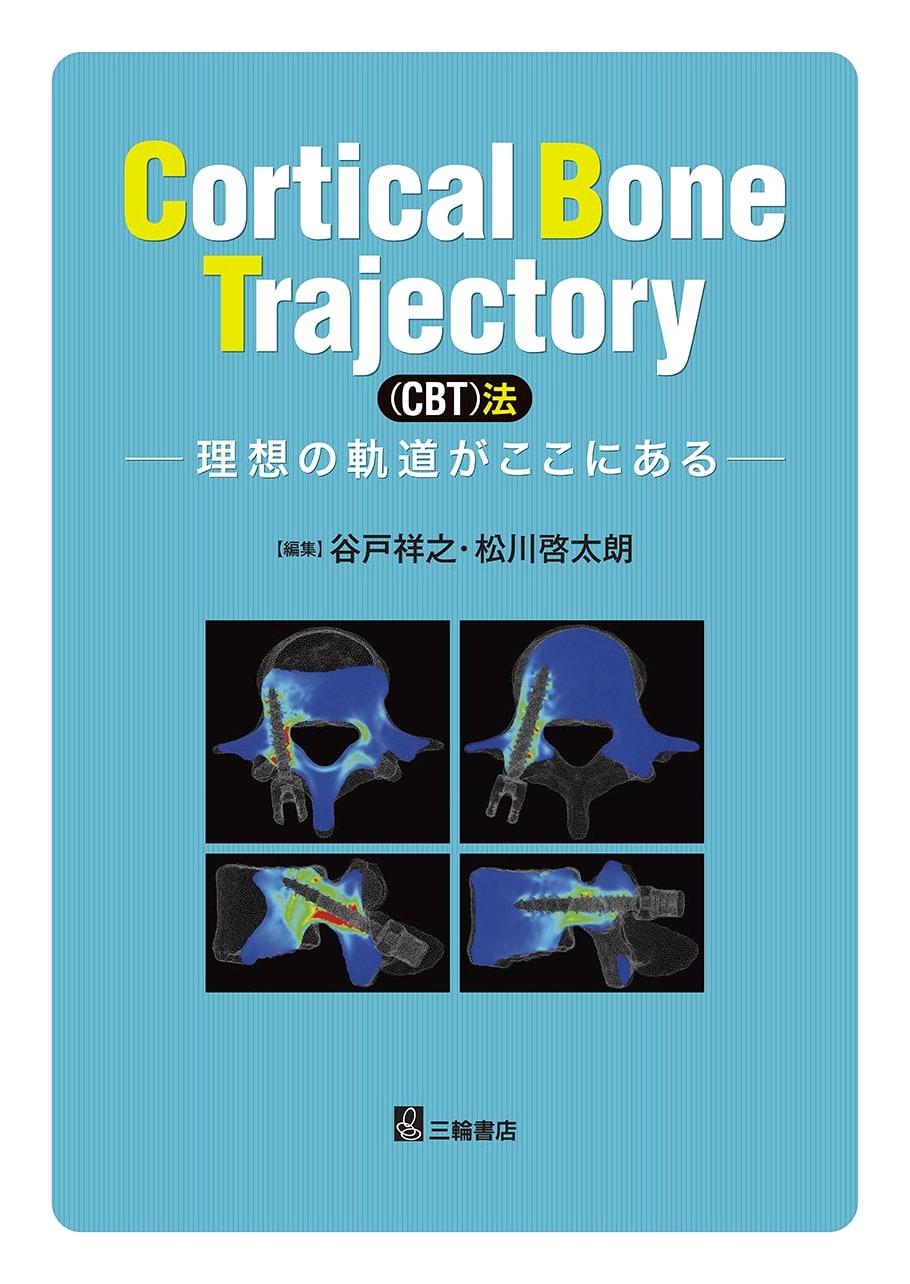 Cortical Bone Trajectory (CBT) Method: Ideal Trajectory Here by Yoshiyuki Yato