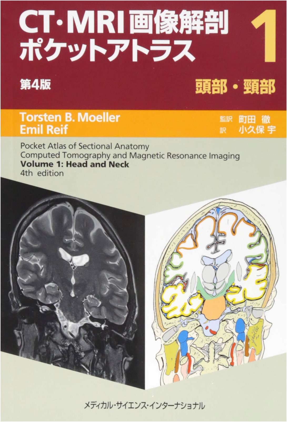 CT/MRI Image Anatomy Pocket Atlas, 4th Ed. Vol. 1: Head & Neck
