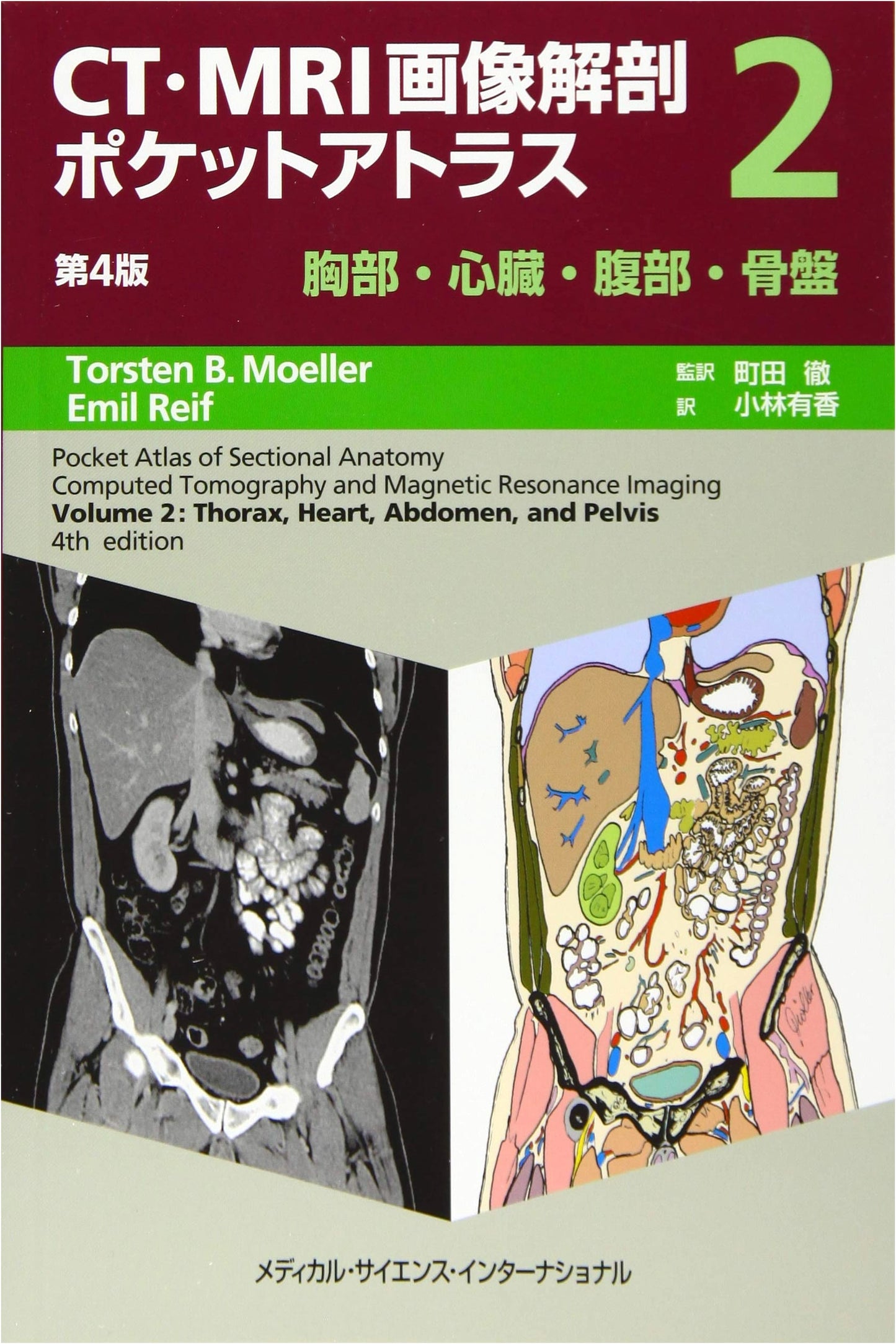 CT and MRI Image Anatomy Pocket Atlas, 4th Edition, Volume II: Chest, Heart, Abdomen, Pelvis