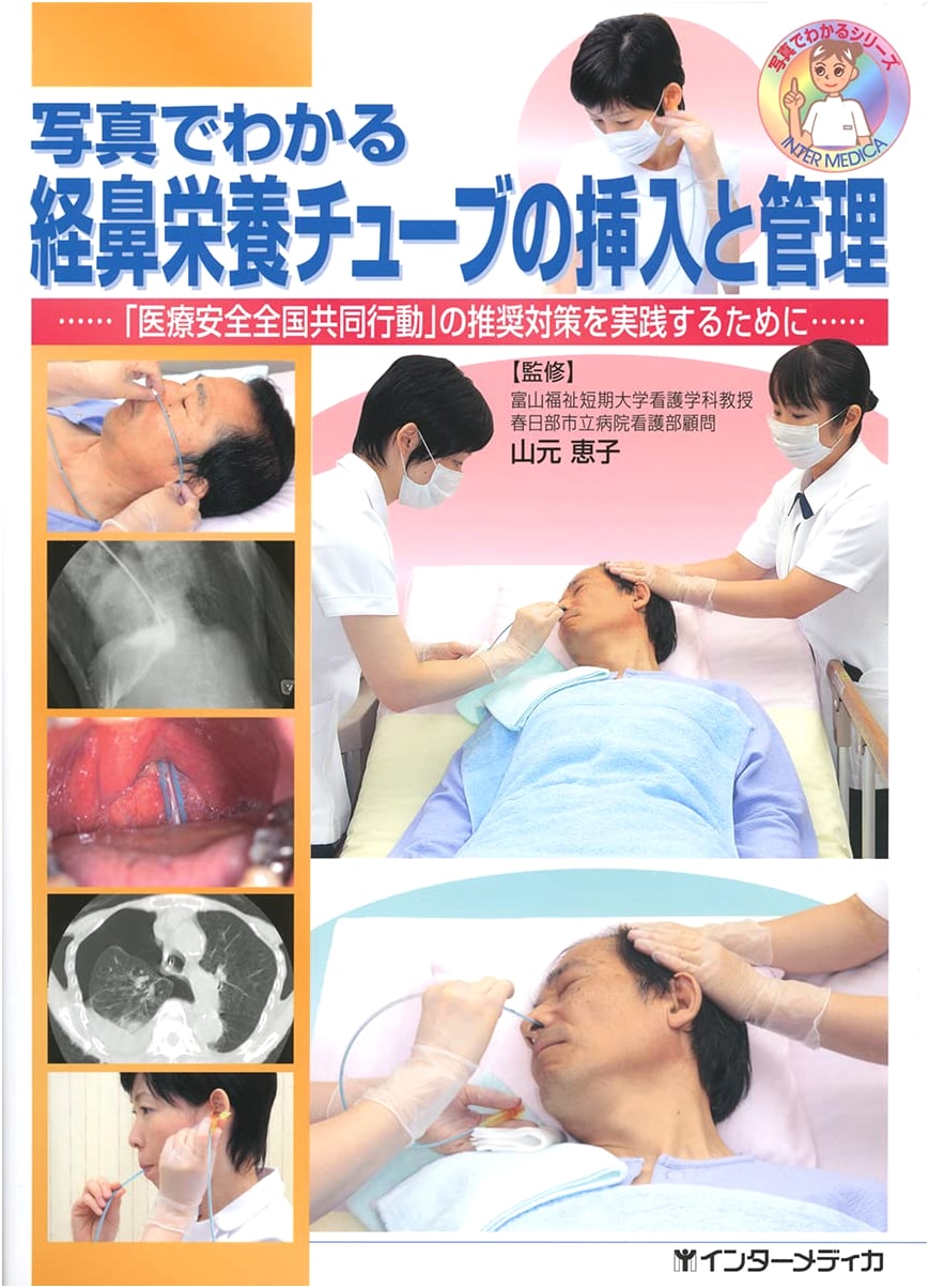 Nasoenteric Feeding Tube Insertion and Management: A Visual Guide